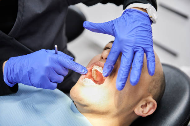 Best Emergency Dental Filling Replacement  in Wilsonville, OR