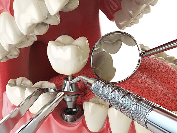 Best Emergency Gum Pain Relief  in Wilsonville, OR